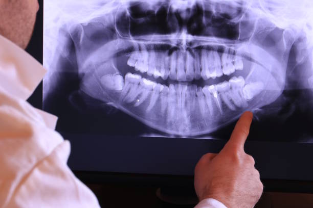 Best Emergency Tooth Extraction in South Duxbury, MA