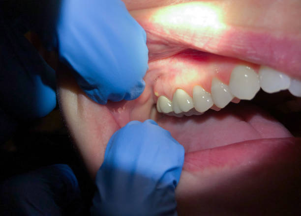 Best Pediatric Emergency Dentist in South Duxbury, MA