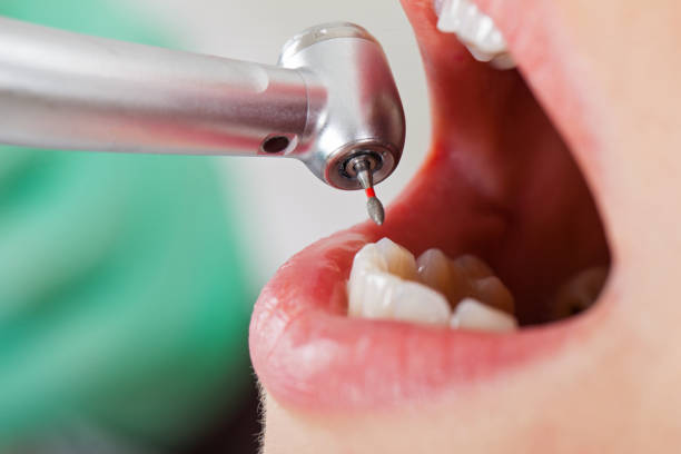 Fast & Reliable Emergency Dental Services in MA
